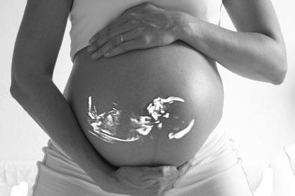 Ultraschall des Babys im Bauch